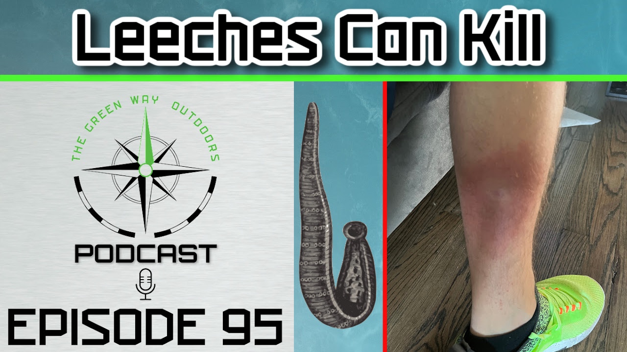 Ep 95: Leeches Can Kill